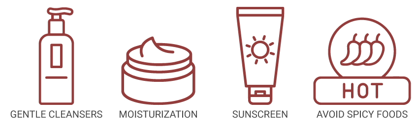 infographic for ways to prevent Rosacea for the blog about Finding Better Relief: 3 CBD Creams for Rosacea and Their Potential Benefits